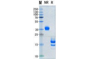 Validation with Western Blot (IL-5 Protein)