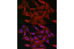 Immunofluorescence analysis of NIH-3T3 cells using Gelsolin Rabbit pAb (ABIN7267365) at dilution of 1:50 (40x lens).
