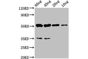 Western Blot Positive WB detected in Recombinant protein All lanes: cyp26b1 antibody at 4. (CYP26B1 Antikörper  (AA 366-511))