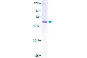 GCLM Protein (AA 1-274) (GST tag)