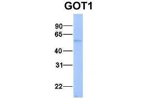 Host:  Rabbit  Target Name:  GOT1  Sample Type:  Human Fetal Liver  Antibody Dilution:  1. (GOT1 Antikörper  (N-Term))