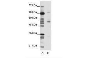 Image no. 1 for anti-Coronin, Actin Binding Protein, 1A (CORO1A) (N-Term) antibody (ABIN202574) (Coronin 1a Antikörper  (N-Term))