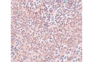 Immunohistochemistry (IHC) image for anti-Nanog Homeobox (NANOG) (Middle Region) antibody (ABIN1031009) (Nanog Antikörper  (Middle Region))