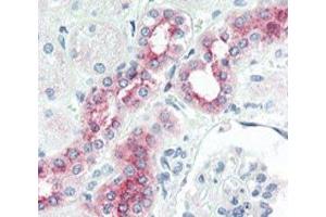 Immunohistochemistry (IHC) image for anti-Bone Morphogenetic Protein Receptor, Type II (serine/threonine Kinase) (BMPR2) (AA 28-59) antibody (ABIN3030192)