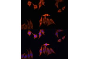 Immunofluorescence analysis of HeLa cells using KRAS antibody (ABIN3021676, ABIN3021677, ABIN3021678, ABIN1513137 and ABIN1514282) at dilution of 1:100. (K-RAS Antikörper)