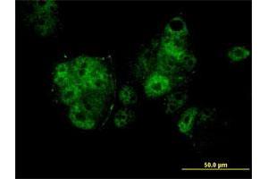Immunofluorescence of monoclonal antibody to MEF2A on MCF-7 cell. (MEF2A Antikörper  (AA 71-170))