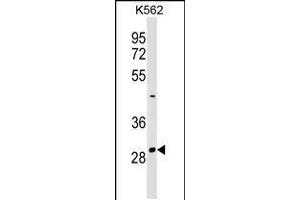 Western blot analysis in K562 cell line lysates (35ug/lane). (NRIP2 Antikörper  (AA 91-119))