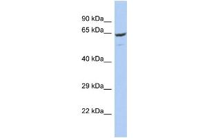 Host: Rabbit Target Name: FBXO21 Sample Type: OVCAR-3 Whole Cell lysates Antibody Dilution: 1. (FBXO21 Antikörper  (C-Term))