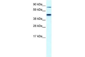 Human Liver; WB Suggested Anti-EPB42 Antibody Titration: 0.