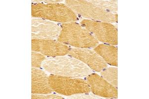 (ABIN6243301 and ABIN6578652) staining SLC29A2 in human skeletal muscle tissue sections by Immunohistochemistry (IHC-P - paraformaldehyde-fixed, paraffin-embedded sections). (SLC29A2 Antikörper  (AA 1-31))