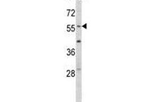 Western Blotting (WB) image for anti-Early Growth Response 1 (EGR1) (AA 9-37) antibody (ABIN3028632)