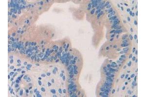IHC-P analysis of Mouse Uterus Tissue, with DAB staining. (HYAL1 Antikörper  (AA 52-462))