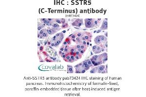 Image no. 1 for anti-Somatostatin Receptor 5 (SSTR5) (C-Term) antibody (ABIN1739677)