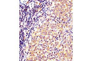 Immunohistochemistry (Paraffin-embedded Sections) (IHC (p)) image for anti-Nuclear Receptor Subfamily 4, Group A, Member 2 (NR4A2) (AA 164-197) antibody (ABIN6243917)