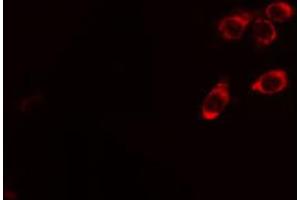 ABIN6267436 staining Hela cells by IF/ICC. (CBL Antikörper  (pTyr674))
