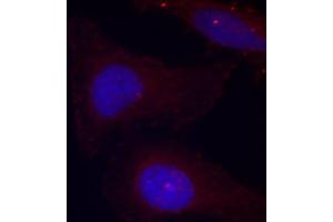 Immunofluorescence staining of methanol-fixed HeLa cells using Phospho-PTK2B-Y402 antibody (ABIN2987623). (PTK2B Antikörper  (pTyr402))