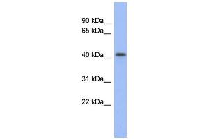 WB Suggested Anti-FIZ1 Antibody Titration: 0. (FIZ1 Antikörper  (Middle Region))