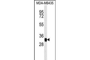 MTCH2 Antibody (N-term) (ABIN651683 and ABIN2840360) western blot analysis in MDA-M cell line lysates (35 μg/lane).