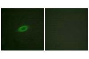 Immunofluorescence analysis of HeLa cells, treated with Forskolin (40nM, 30 mins), using Annexin A6 antibody. (ANXA6 Antikörper)