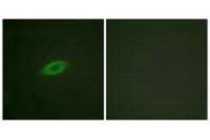 Immunofluorescence analysis of HeLa cells, treated with Forskolin (40nM, 30 mins), using Annexin A6 antibody.
