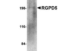 Western Blotting (WB) image for anti-RANBP2-Like and GRIP Domain Containing 5 (RGPD5) (N-Term) antibody (ABIN1031536) (RGPD5 Antikörper  (N-Term))