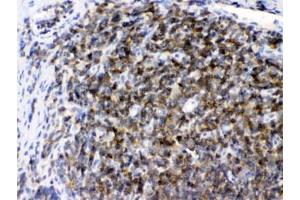 IHC testing of FFPE rat lymph tissue with ARHGEF1 antibody at 1ug/ml. (ARHGEF1 Antikörper  (AA 41-71))