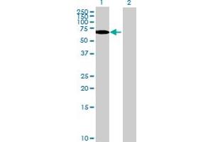 Western Blot analysis of TULP2 expression in transfected 293T cell line by TULP2 MaxPab polyclonal antibody. (TULP2 Antikörper  (AA 1-520))