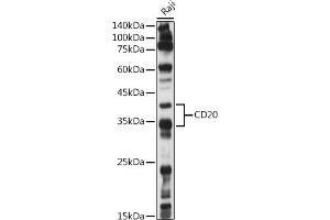 Western blot analysis of extracts of Raji cells, using CD20 antibody (ABIN7268473) at 1:1000 dilution. (CD20 Antikörper  (AA 208-297))