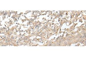 Immunohistochemistry of paraffin-embedded Human tonsil tissue using ZZZ3 Polyclonal Antibody at dilution of 1:50(x200) (ZZZ3 Antikörper)