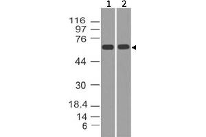 Image no. 1 for anti-Tumor Protein P73 (TP73) antibody (ABIN5027773) (Tumor Protein p73 Antikörper)