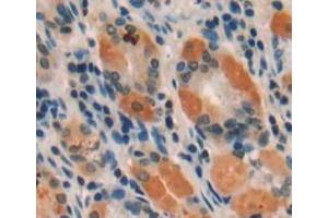 Used in DAB staining on fromalin fixed paraffin-embedded stomach tissue (Intrinsic Factor Antikörper  (AA 198-413))