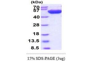 SDS-PAGE (SDS) image for Thymidine Phosphorylase (TYMP) (AA 11-482) protein (His tag) (ABIN667826)