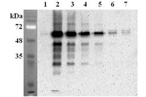 Immunoprecipitation confirmed by recombinant mouse FTO. (FTO Antikörper)