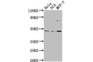 Western Blot Positive WB detected in: Hela whole cell lysate, PC-3 whole cell lysate, MCF-7 whole cell lysate All lanes: TMEM237 antibody at 1:2000 Secondary Goat polyclonal to rabbit IgG at 1/50000 dilution Predicted band size: 46, 45, 49, 36, 47 kDa Observed band size: 46 kDa (TMEM237 Antikörper  (AA 59-78))
