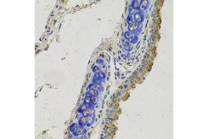 Immunohistochemistry of paraffin-embedded mouse lung using GAS6 antibody (ABIN5996448) at dilution of 1/100 (40x lens). (GAS6 Antikörper)