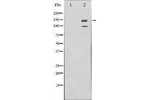 Western blot analysis of IGF1R expression in A549 whole cell lysates,The lane on the left is treated with the antigen-specific peptide. (IGF1R Antikörper  (C-Term))