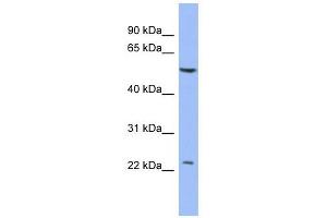PABPC1L2A antibody used at 1 ug/ml to detect target protein. (PABPC1L2A Antikörper)