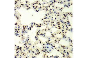 Immunohistochemistry of paraffin-embedded rat lung using SUMO2 antibody (ABIN6128719, ABIN6148726, ABIN6148728 and ABIN6218594) at dilution of 1:100 (40x lens). (SUMO2 Antikörper  (AA 1-95))