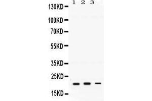 Anti-GTPase HRAS antibody, Western blotting All lanes: Anti GTPase HRAS  at 0. (HRAS Antikörper  (C-Term))