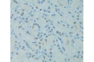 Immunohistochemistry of paraffin-embedded Rat pancreas using GTF2H2C Polyclonal Antibody at dilution of 1:100 (40x lens).