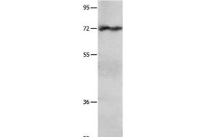 Western Blot analysis of Hela cell using IGF2BP1 Polyclonal Antibody at dilution of 1:750