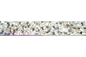 Rabbit Anti-FLI1 Antibody       Paraffin Embedded Tissue:  Human cardiac cell   Cellular Data:  Epithelial cells of renal tubule  Antibody Concentration:   4. (FLI1 Antikörper  (Middle Region))