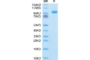 Rhesus macaque LILRB1 on Tris-Bis PAGE under reduced condition. (LILRB1 Protein (AA 1-474) (Fc Tag))