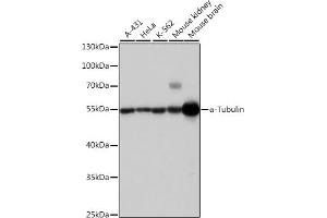 Western blot analysis of extracts of various cell lines, using α-Tubulin antibody (ABIN3020549, ABIN3020550 and ABIN3020551) at 1:1000 dilution. (TUBA4A Antikörper  (AA 1-180))