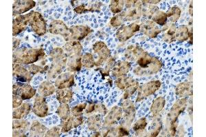 IHC analysis of PCK1/PEPC using anti-PCK1/PEPC antibody (ABIN7599502). (PCK1 Antikörper  (AA 1-622))