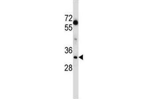 Western Blotting (WB) image for anti-Lactate Dehydrogenase A (LDHA) (AA 204-232) antibody (ABIN3031580)