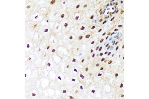 Immunohistochemistry of paraffin-embedded human esophageal using UB Rabbit mAb (ABIN7271185) at dilution of 1:100 (40x lens).