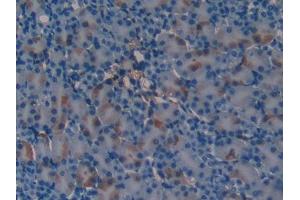 DAB staining on IHC-P; Samples: Mouse Kidney Tissue (SERPINA6 Antikörper  (AA 57-256))