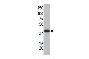 The anti-SUMO1 polyclonal antibody (ABIN388027 and ABIN2845493) is used in Western blot to detect GST-SUMO1 fusion protein. (SUMO1 Antikörper  (C-Term))