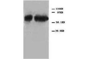 Western blot analysis of Hela cell lysis using P73alpha antibody (Tumor Protein p73 Antikörper  (C-Term))